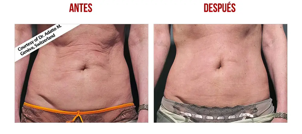 testimonios-clientes-01-low_res-scale-2_00x