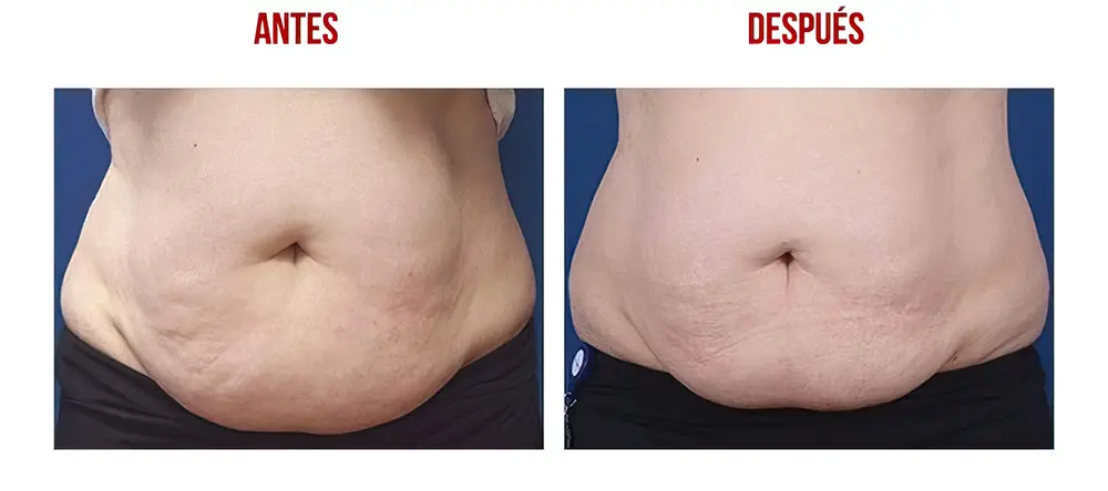 testimonios-clientes-02-low_res-scale-2_00x