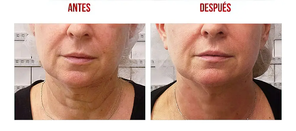 testimonios-clientes-03-lharmonie