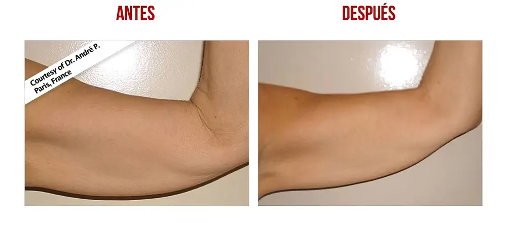 testimonios-clientes-04-low_res-scale-2_00x