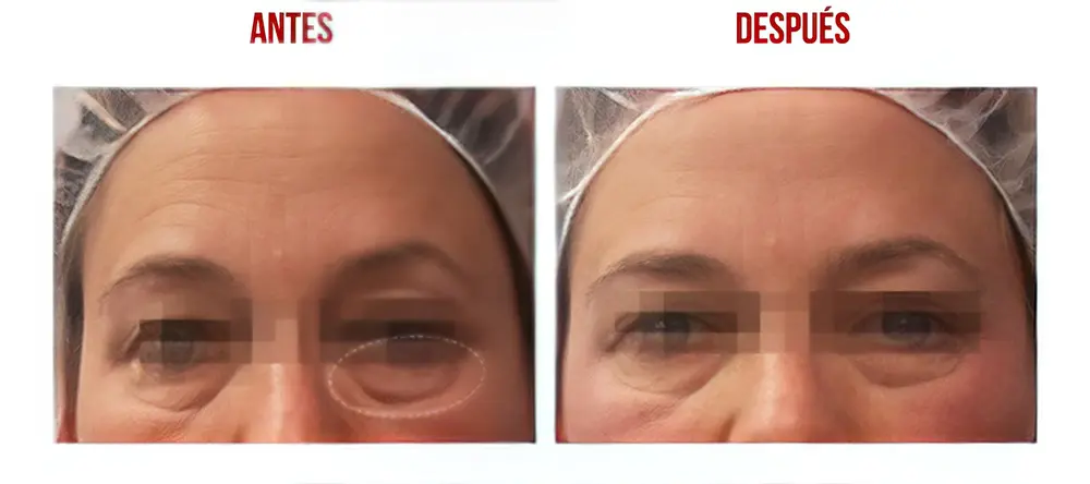 testimonios-clientes-05-lharmonie