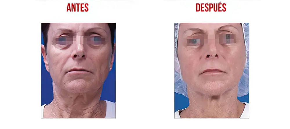 testimonios-clientes-06-lharmonie