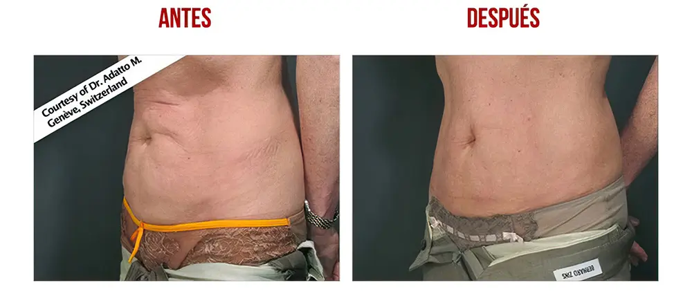 testimonios-clientes-07-low_res-scale-2_00x