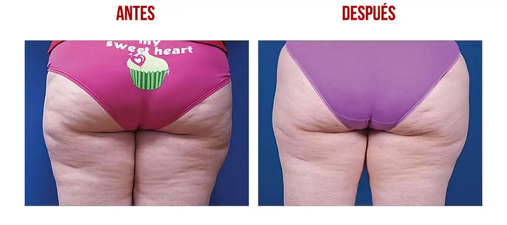 testimonios-clientes-08-low_res-scale-2_00x