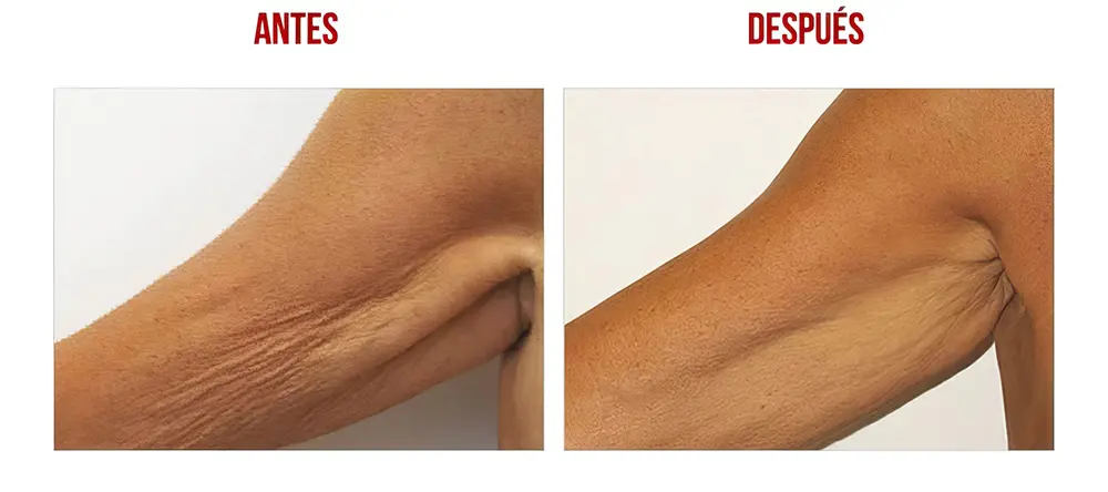 testimonios-clientes-09-low_res-scale-2_00x