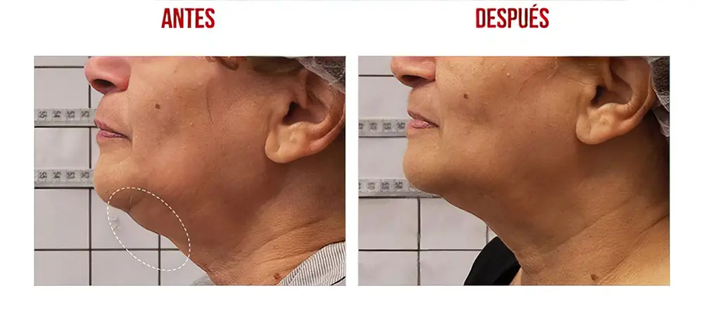 testimonios-clientes-10-lharmonie