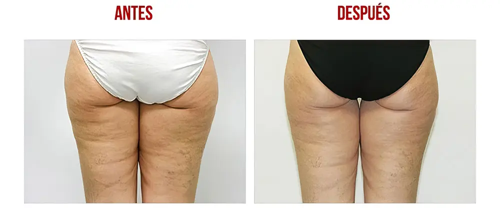 testimonios-clientes-13-low_res-scale-2_00x