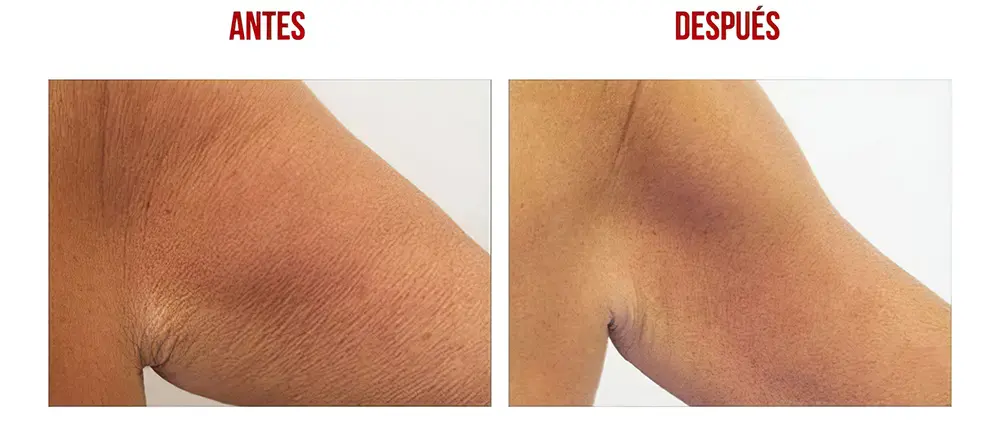 testimonios-clientes-14-low_res-scale-2_00x