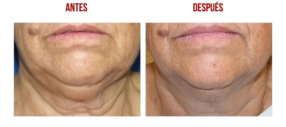 testimonios-clientes-15-lharmonie